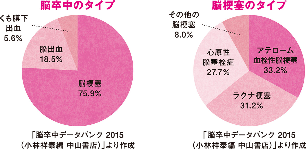 脳卒中のタイプ、脳梗塞のタイプ 円グラフ