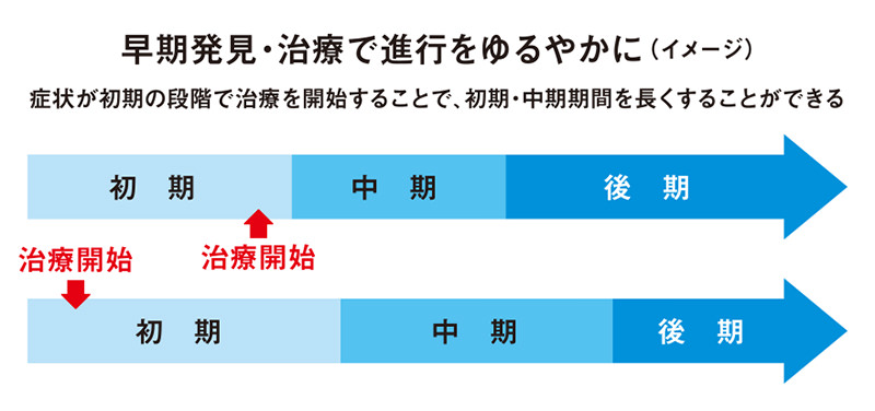 早期発見・治療で進行をゆるやかに（イメージ）